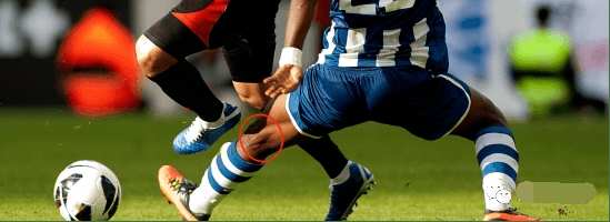 如何预防前交叉韧带损伤