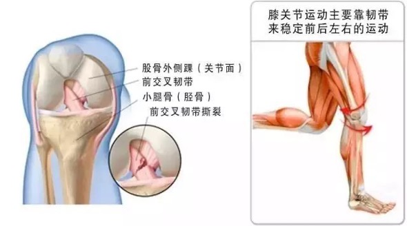 世界杯狂欢背后，这些运动损伤该如何预防和处理？