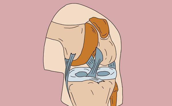 半月板损伤，是咋回事？还有机会修复吗？能不能跑步？