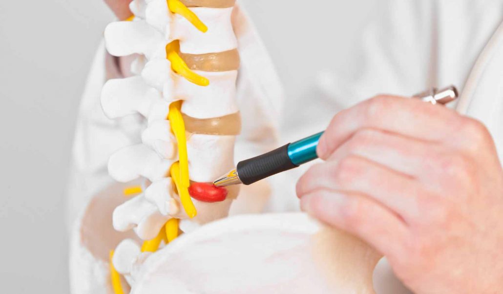 拿什么拯救你，我的腰椎间盘突出！