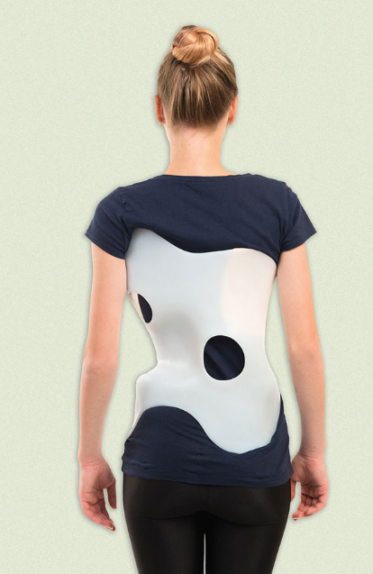 脊柱侧弯支具有用吗？戴了支具还用做康复训练吗？