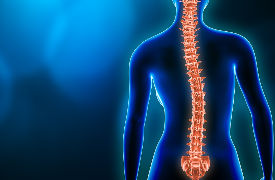 如何科学选择青少年特发性脊柱侧弯的矫正方法？