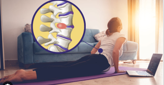 腰椎间盘突出的那些事儿：常见症状及非手术方法