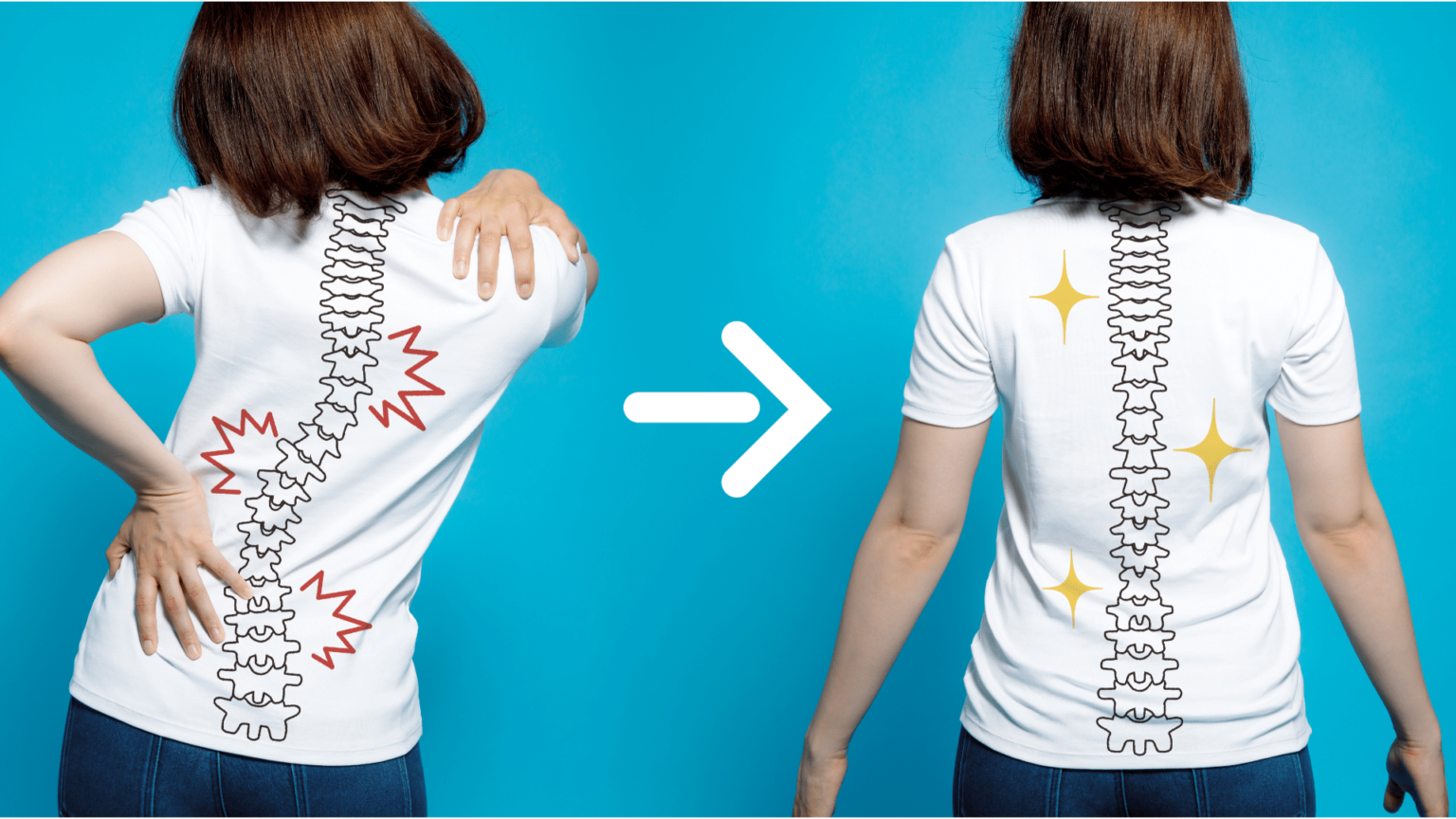 脊柱侧弯自我矫正方法