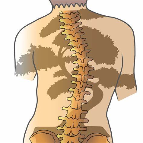 脊柱侧弯怎么办？
